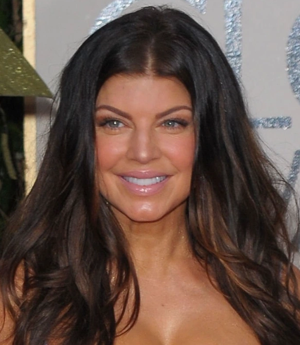 fergie teeth in 2010