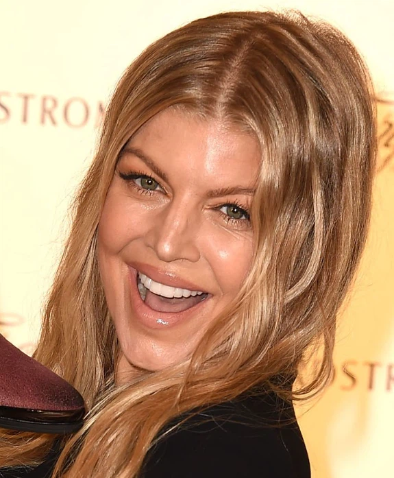 fergie teeth in 2015