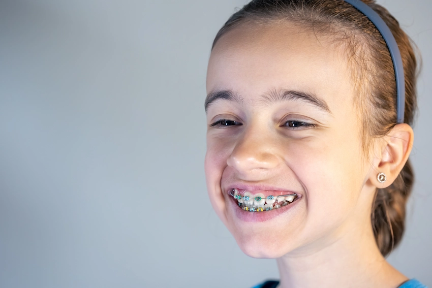 how do teeth look before and after braces