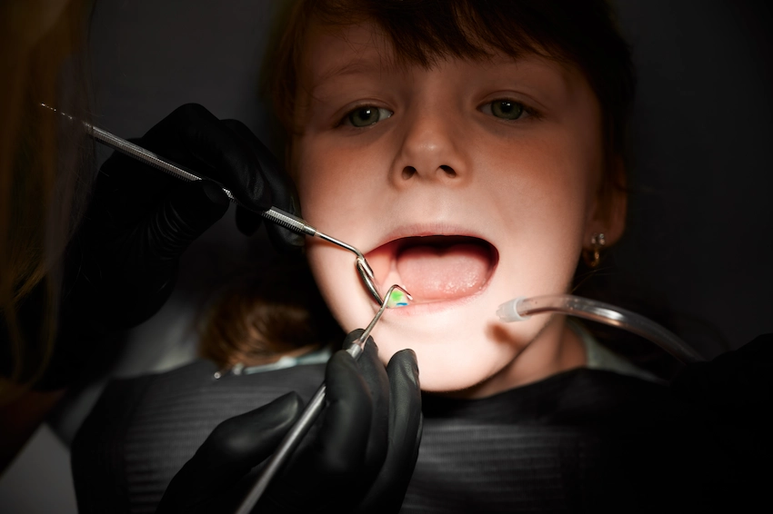 how is tooth extraction performed in children