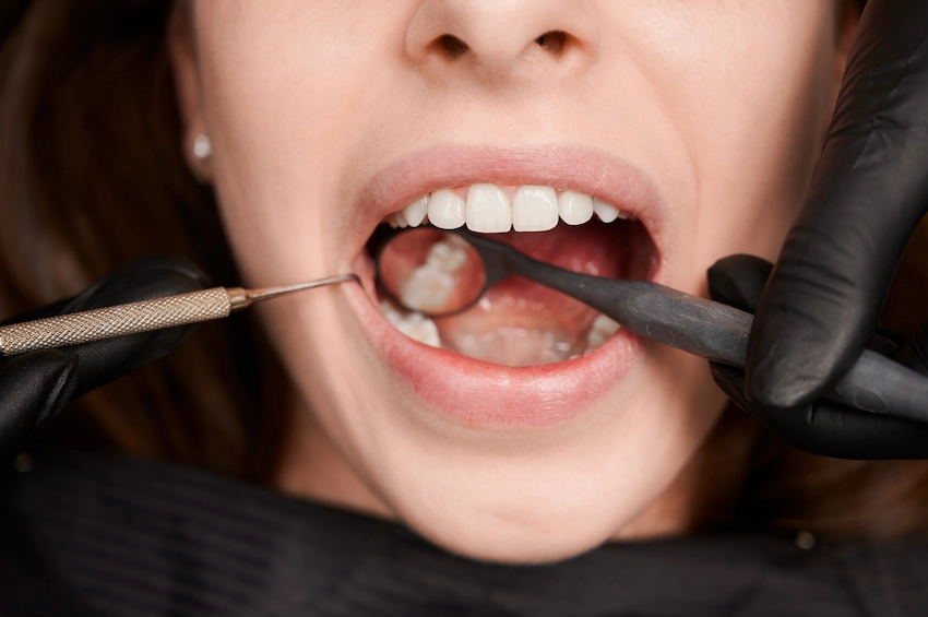 how long will it take to recover after a tooth extraction