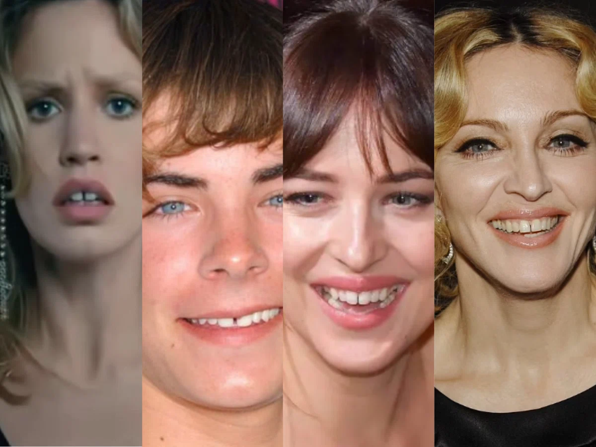 how to fix gap teeth