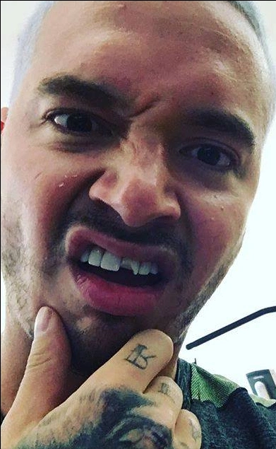 j balvin dişleri 2016