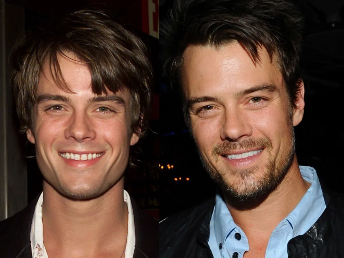 josh duhamel teeth before after