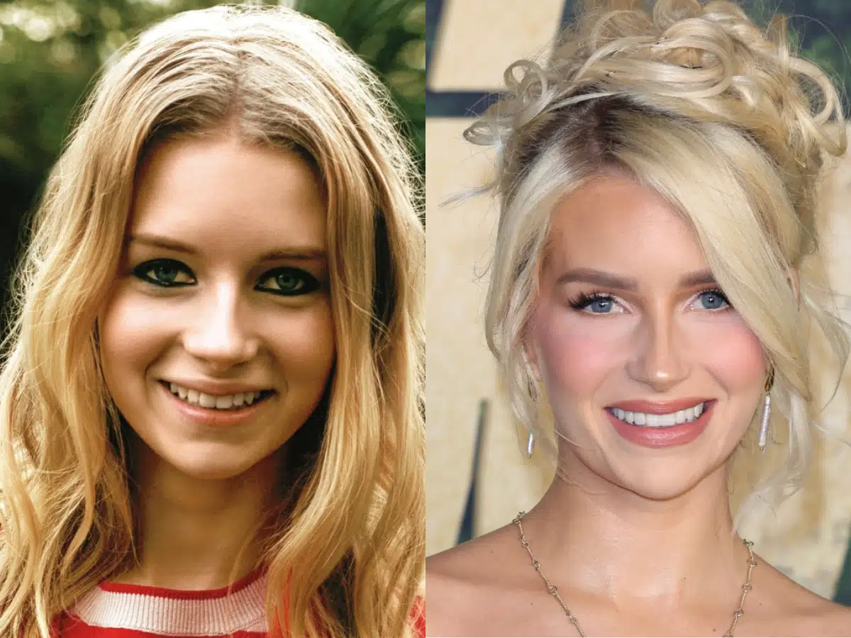 lottie moss teeth before after