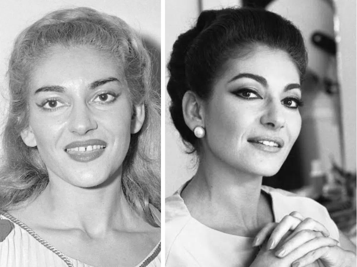 maria callas teeth before after