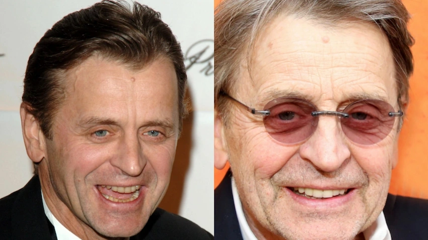 mikhail baryshnikov teeth before after