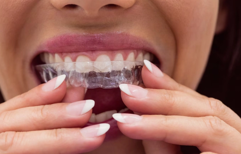 patient wearing braces