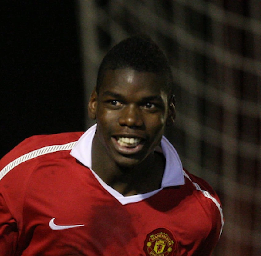 paul pogba zähne 2010