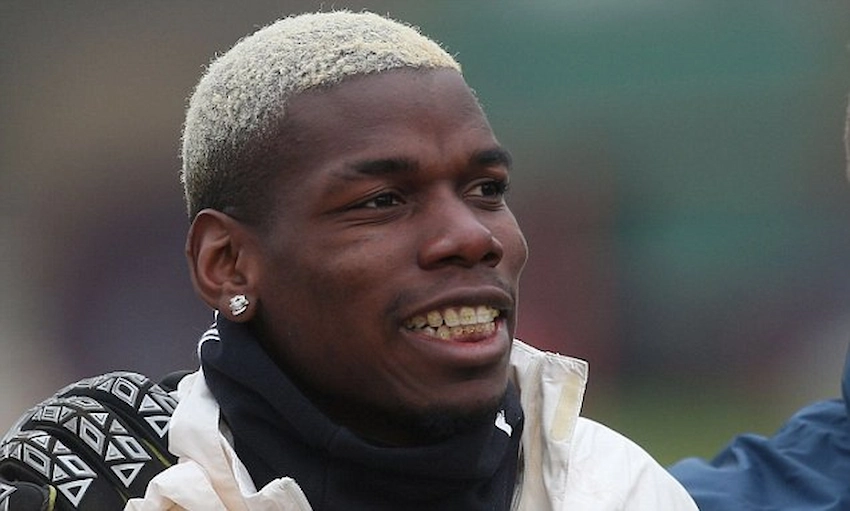 paul pogba zähne 2015