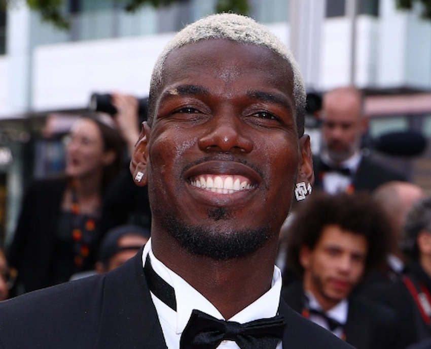 paul pogba zähne 2025