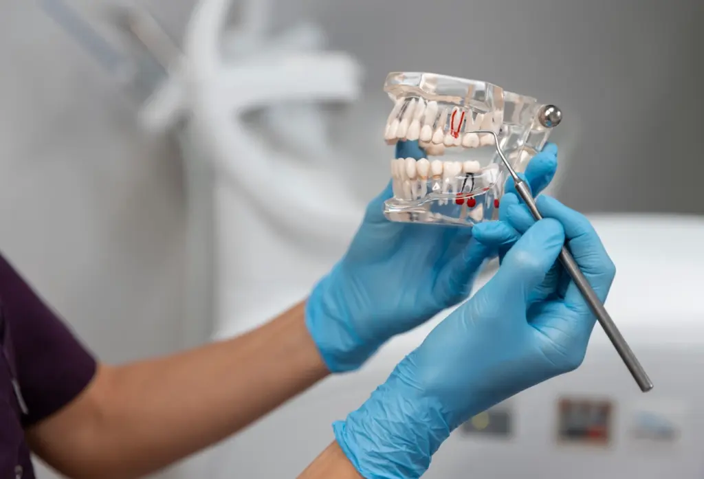 screwless dental implants