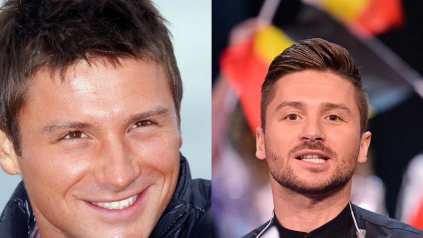 sergey lazarev amazing teeth