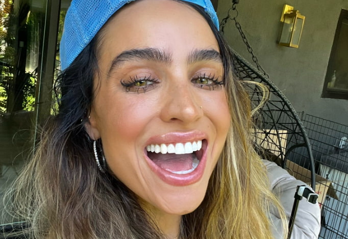 sommer ray teeth cover