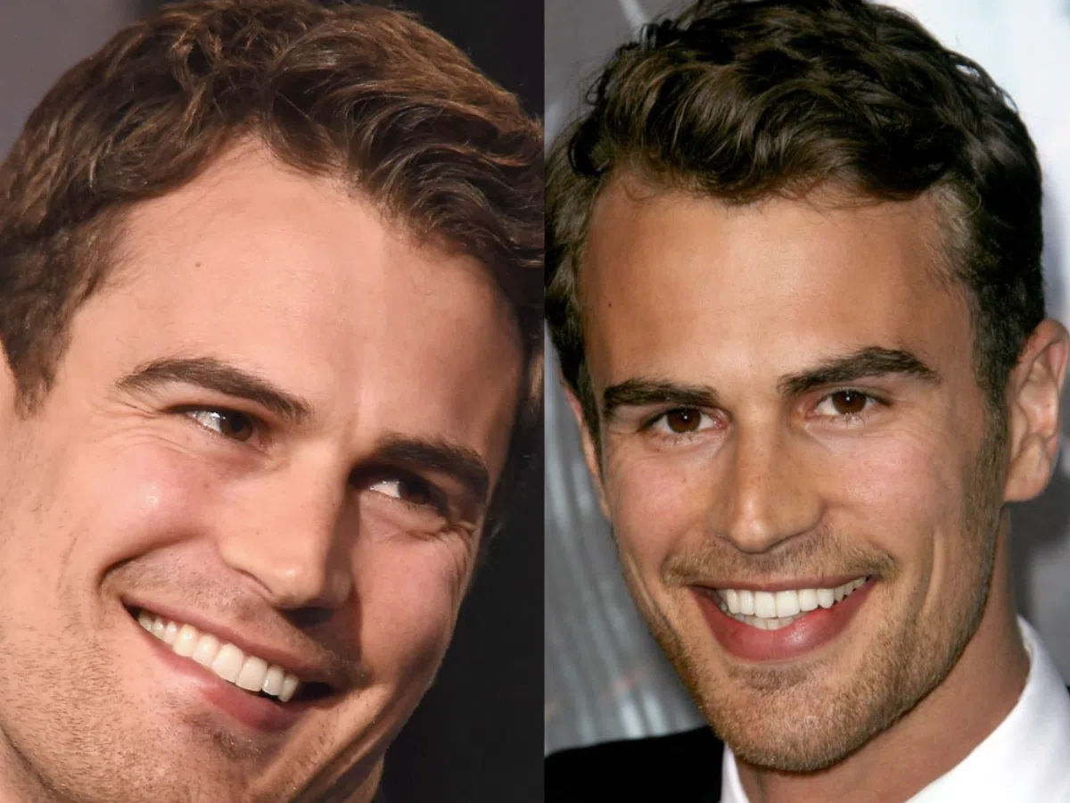 theo james teeth before after