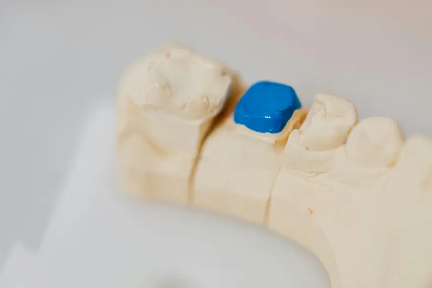 tooth filling process