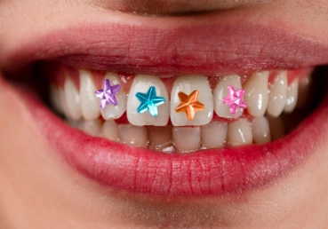 tooth gems (2)