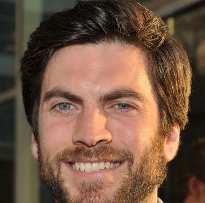 wes bentley dents 2010