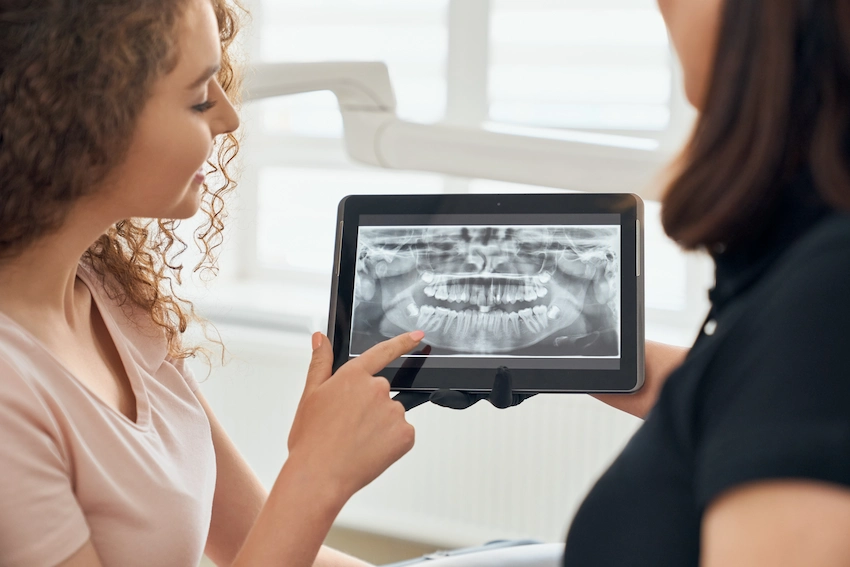 what is a dental x ray and how is it taken