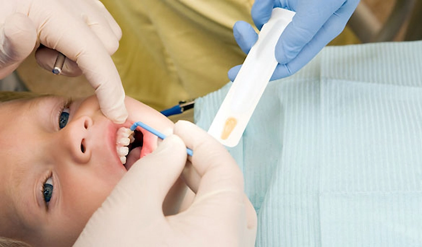what is fluoride and what are its benefits for teeth