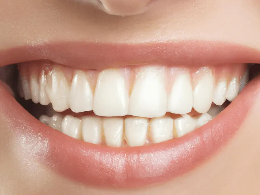 white teeth pen
