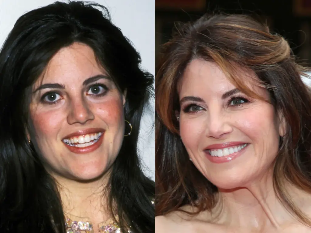 Monica Lewinsky Then and Now Teeth Transformation LEMA