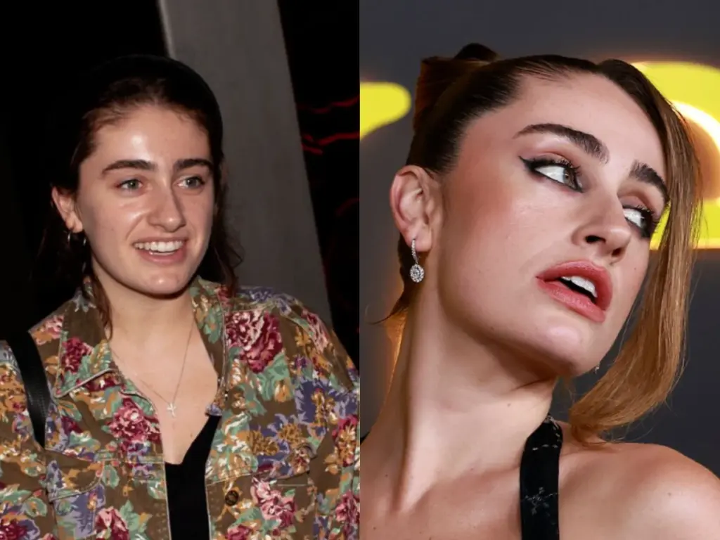 Rachel ‍ ‌‍ ‍‌ ‍ ‌‍ ‍‌ Sennott's Teeth Transformation Over the Years LEMA