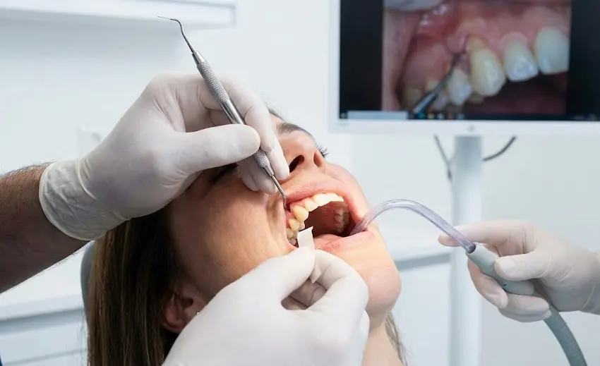 leczenie recesji dziąseł