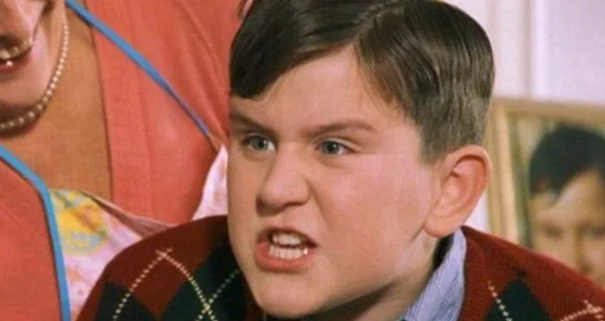 أسنان هاري ميلينج في عام 2000