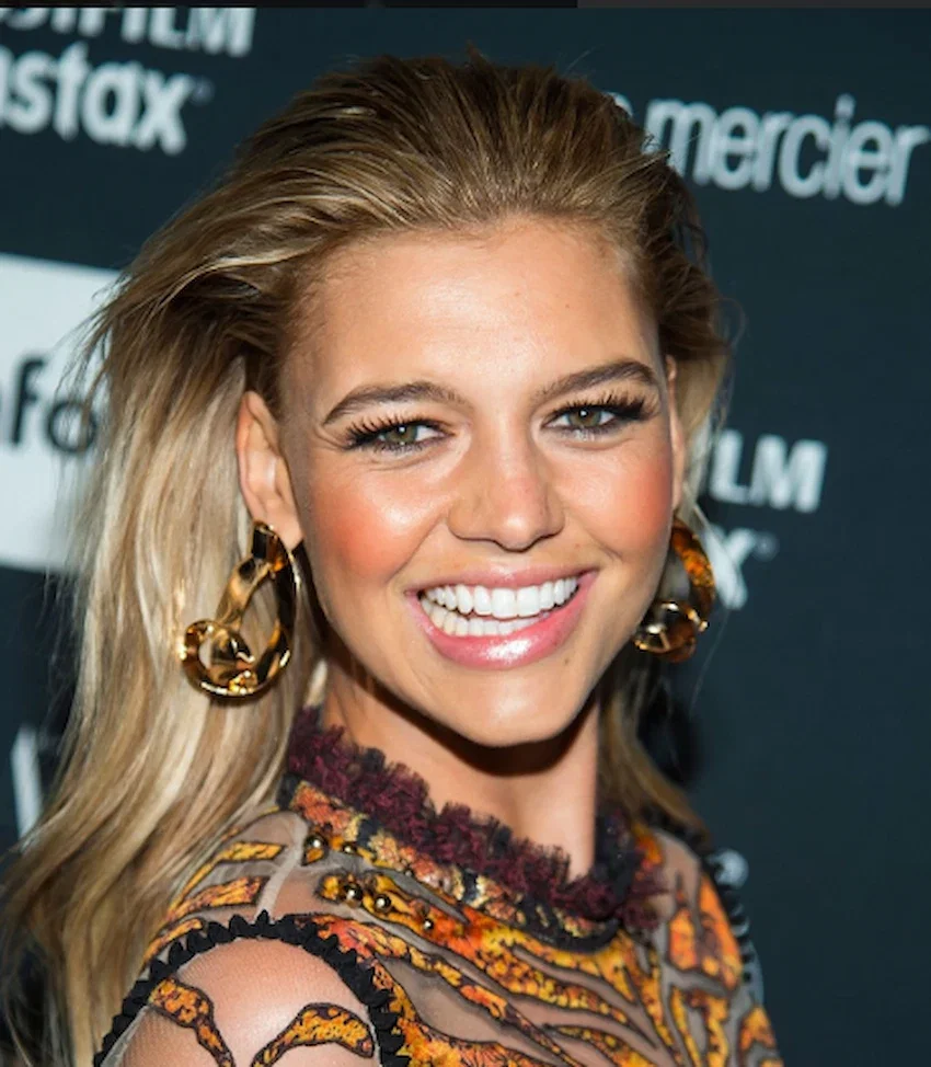 kelly rohrbach teeth 2017 1