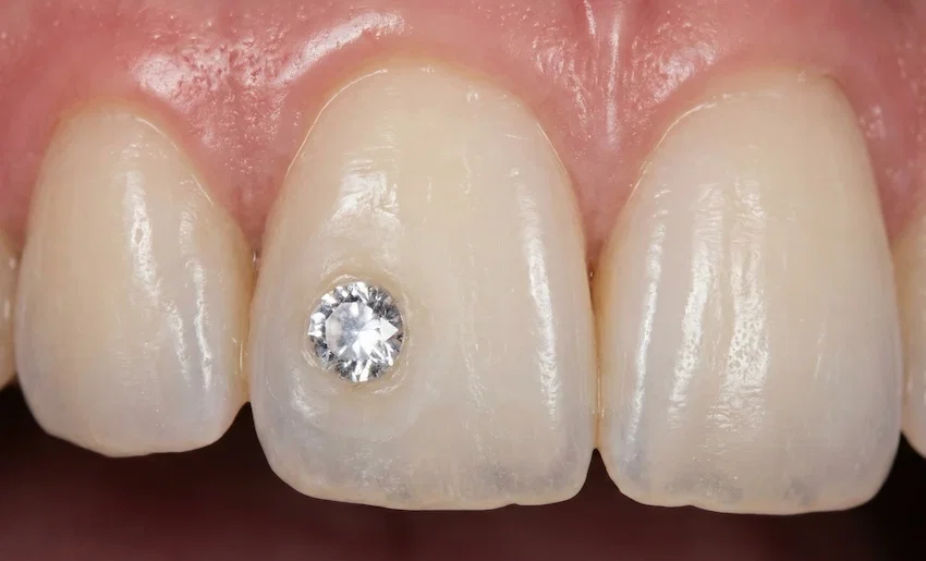 Coronas De Diamante Brocas Corona Diamante Alto Rendimiento Hormigón Armado BM Brocas De Diamante Para Perforación