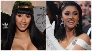 Cardi B Dientes Antes Después