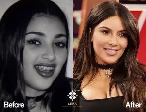 kim kardashian diantes