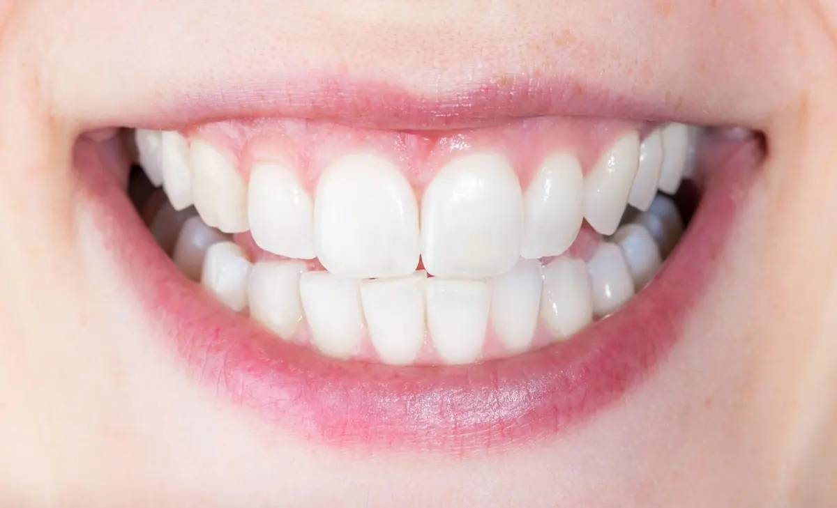 smalt-dentar