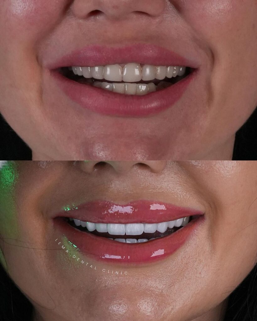 lema dental clinic