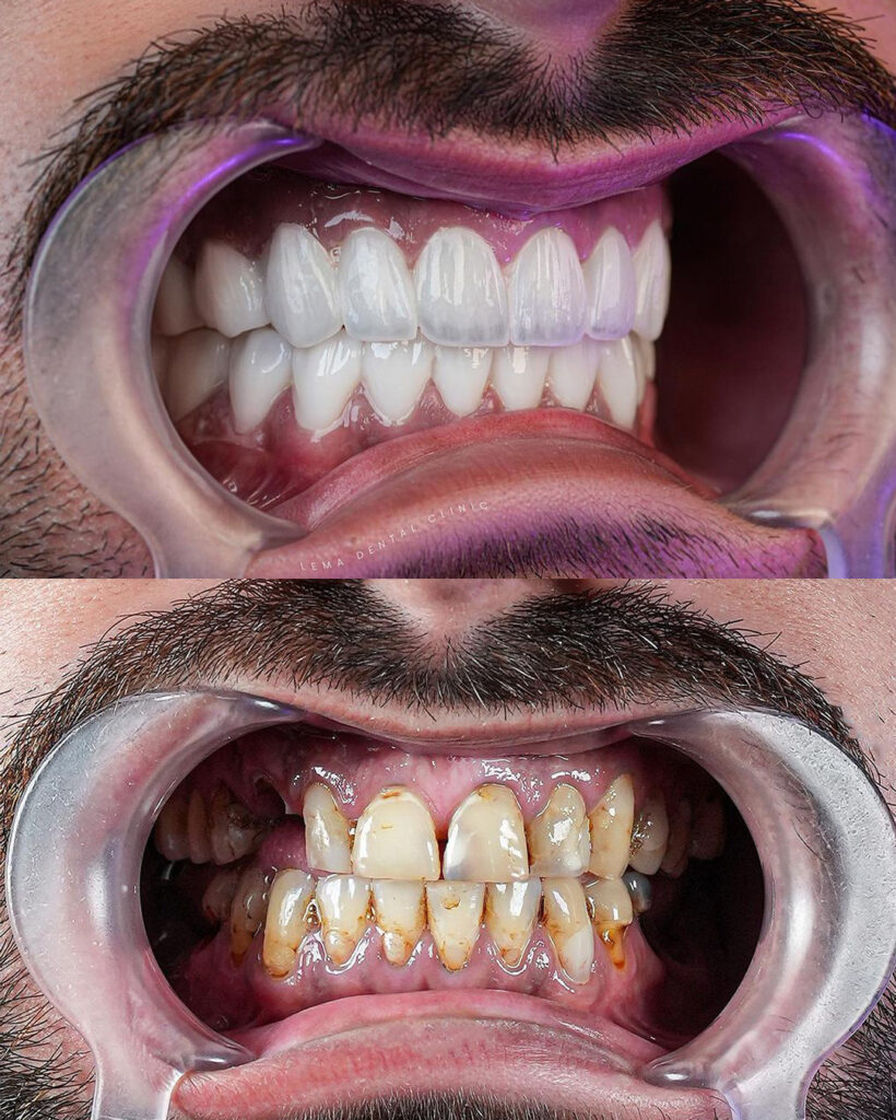 lema dental clinic