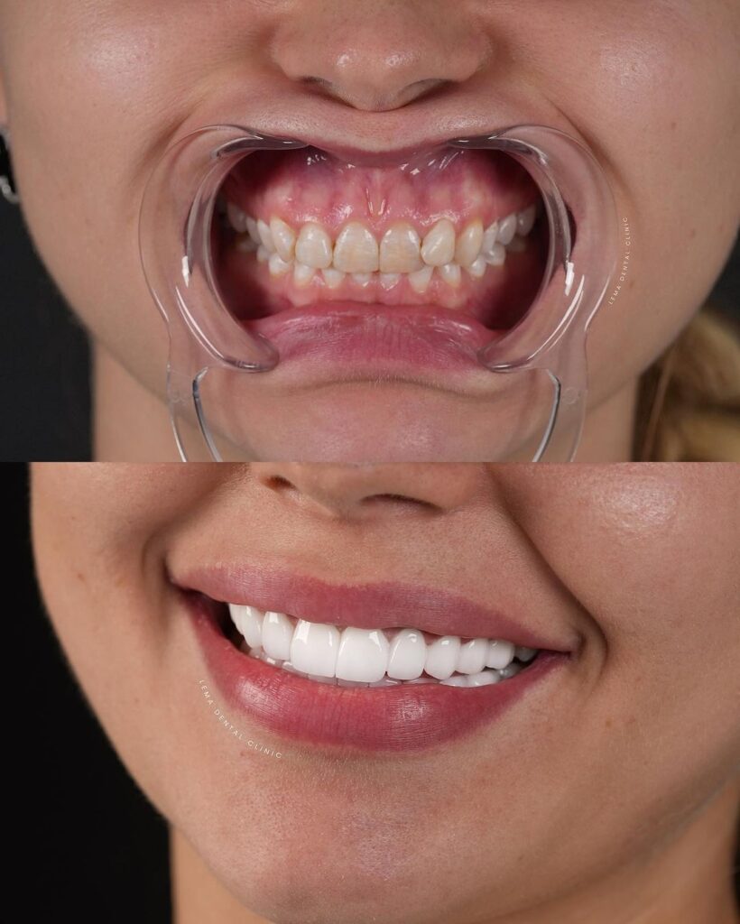lema dental clinic